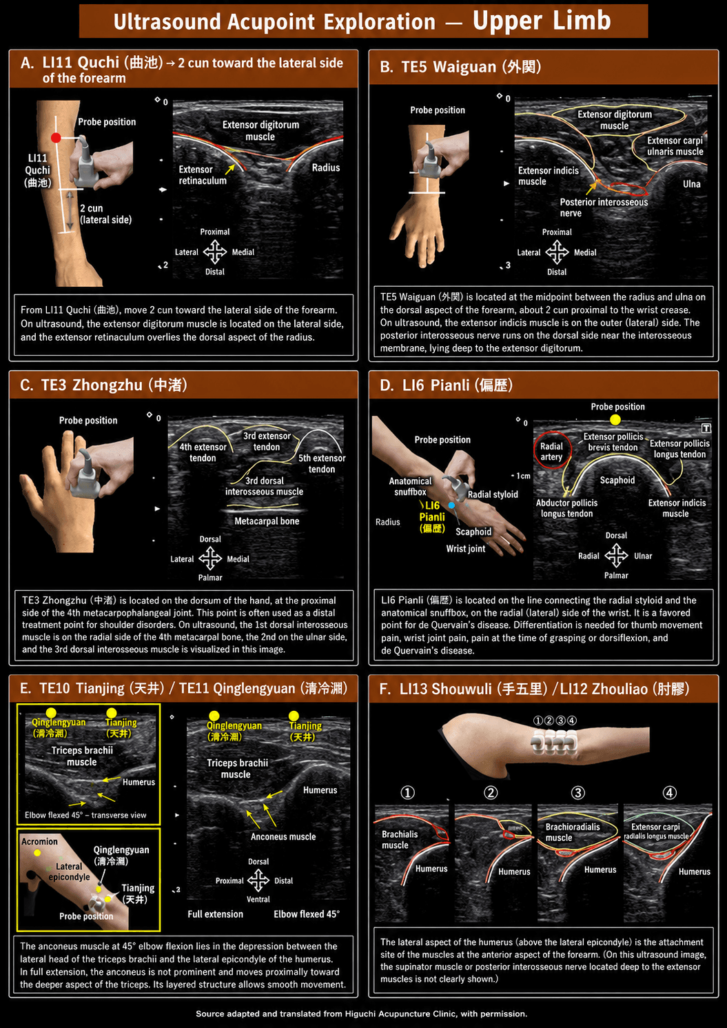 Visual concept preview illustrating the planned Upper Limb ultrasound acupoint anatomy section — an AI-generated mockup, not final educational content.
